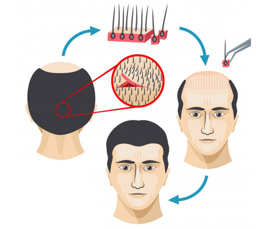 𝐁𝐨𝐨𝐤 𝐲𝐨𝐮𝐫  DermaVue Skin Cosmetology  Hair Transplant   Facebook