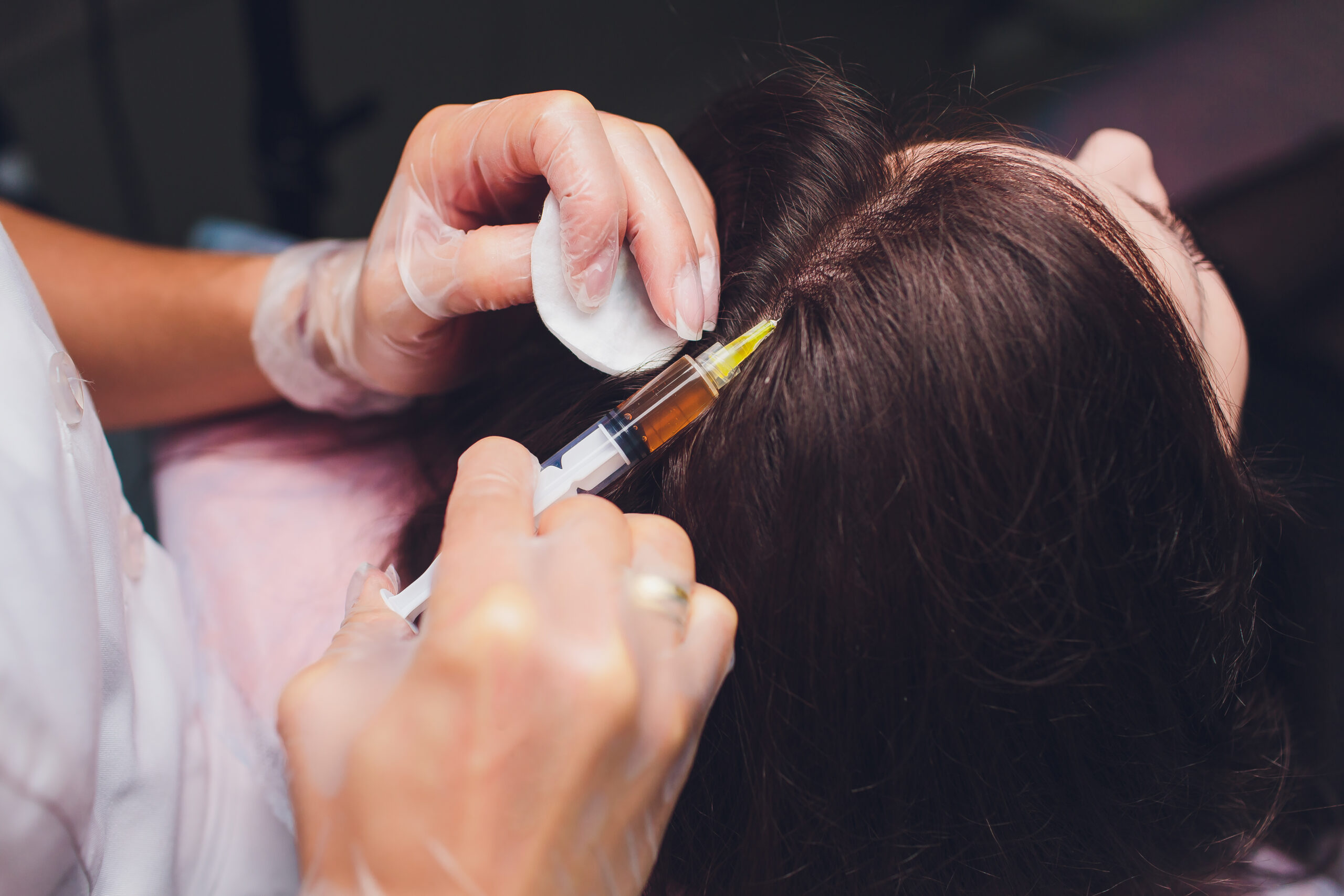 PRP Treatment for Hair Growth & Hair Fall - Cosmetiq Clinic