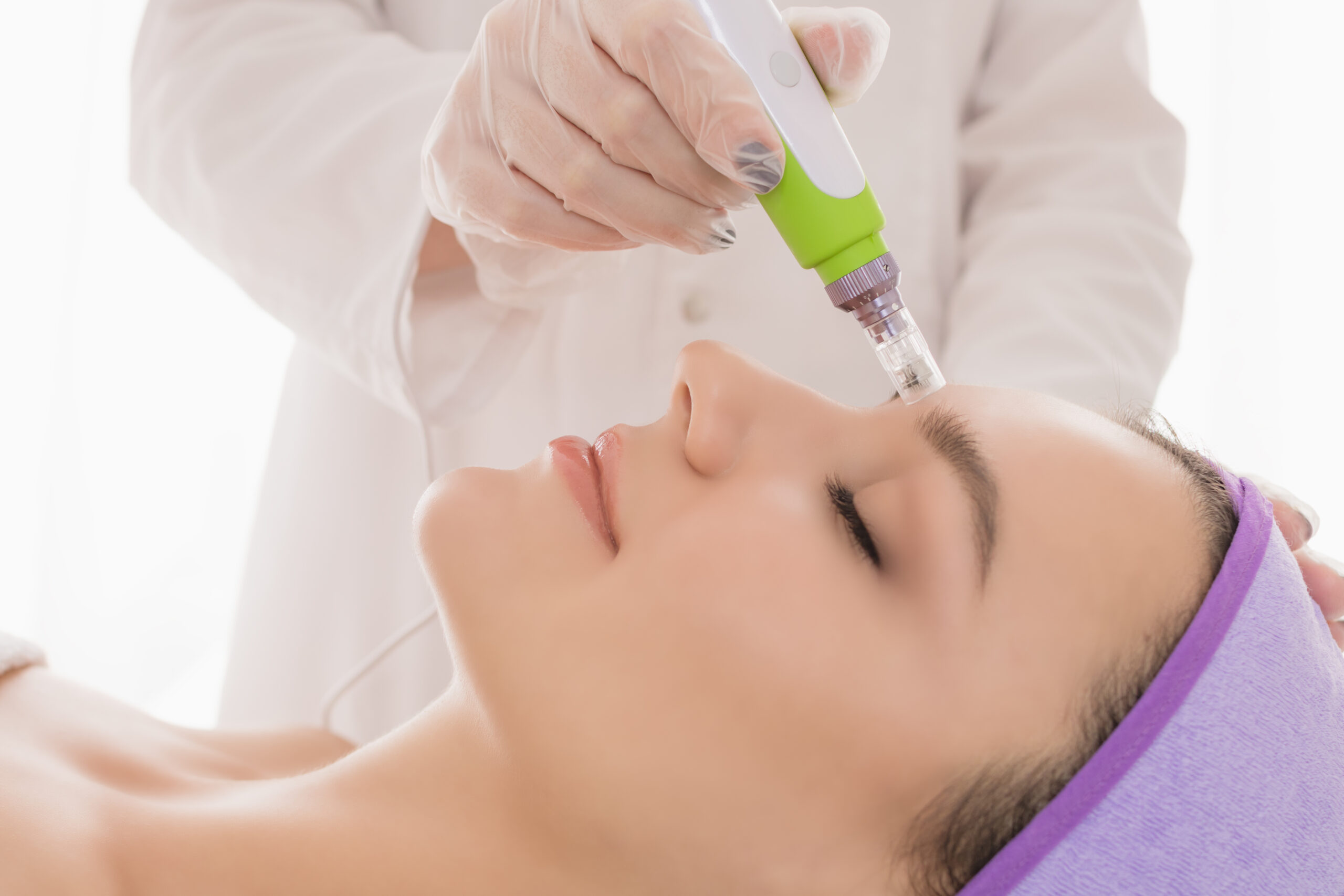 Fractional mesotherapy.A young beautiful woman in the cosmetologist’s office receives fractional mesotherapy for her face. Facial skin rejuvenation. Acne treatment. Hardware cosmetology. Beautician.