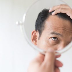 Men are worried about hair loss.